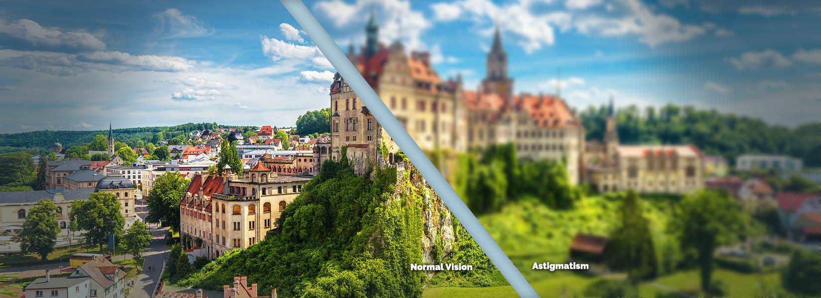 Astigmatism Treatment in Flower Mound