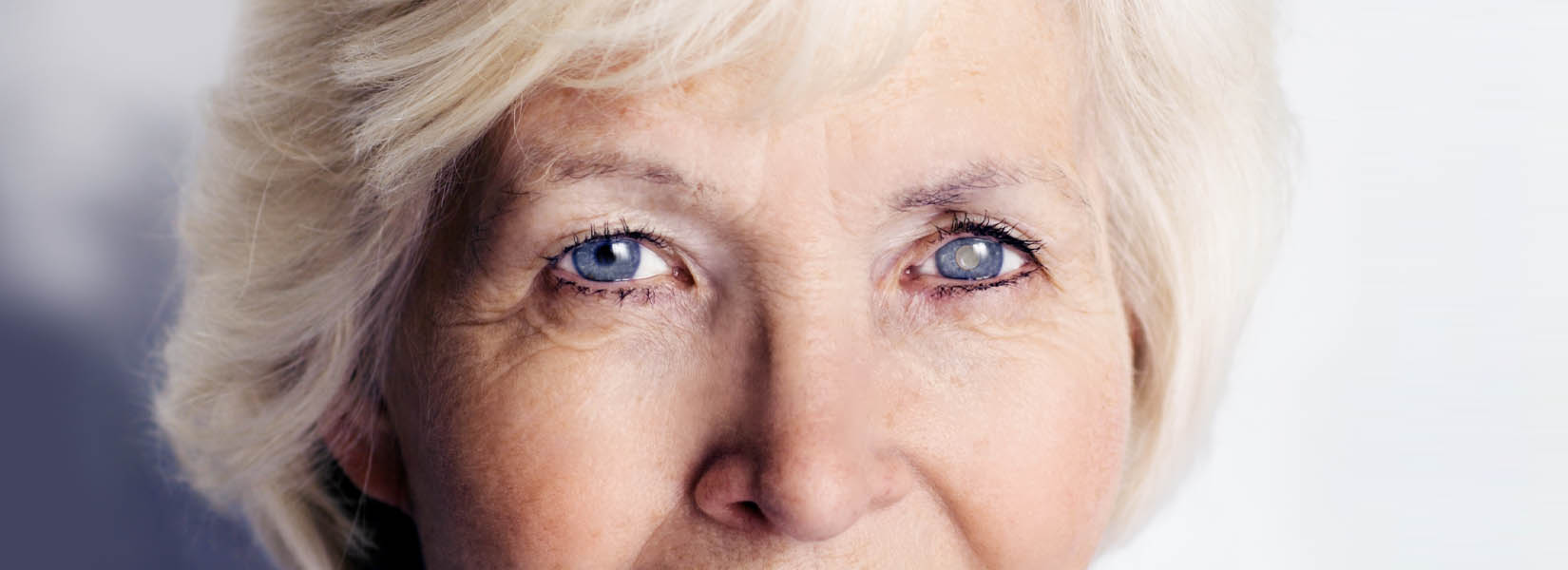 Cataract Surgery in Flower Mound